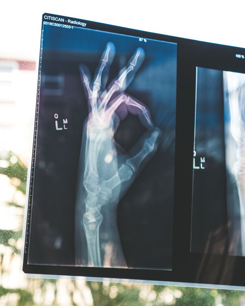 Left hand on xray holding "OK" sign. It is OK and important to be aware of your sexual health.